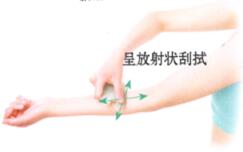 疖病-痈肿的刮痧疗法