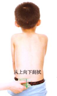 小儿便秘的刮痧疗法