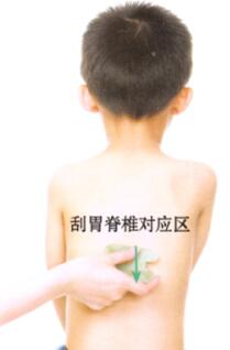 小儿腹泻的刮痧疗法
