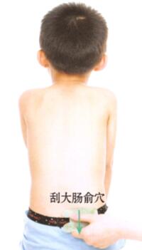 小儿腹泻的刮痧疗法