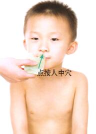 小儿惊风的刮痧疗法