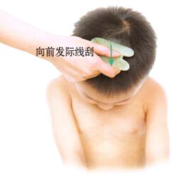 小儿惊风的刮痧疗法