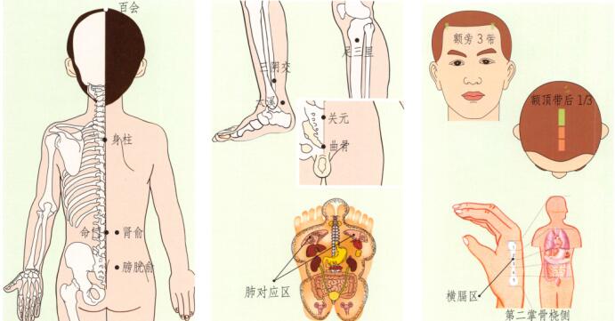 小儿遗尿的刮痧疗法