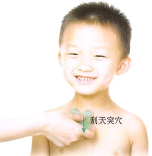 百日咳的刮痧疗法