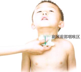 百日咳的刮痧疗法