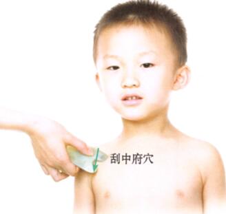 百日咳的刮痧疗法