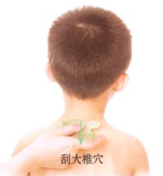 百日咳的刮痧疗法