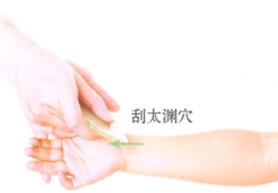 百日咳的刮痧疗法
