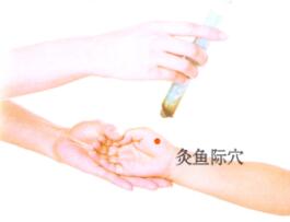 百日咳的刮痧疗法