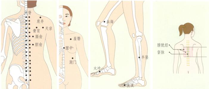 乳腺增生的刮痧疗法
