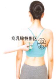 乳腺增生的刮痧疗法