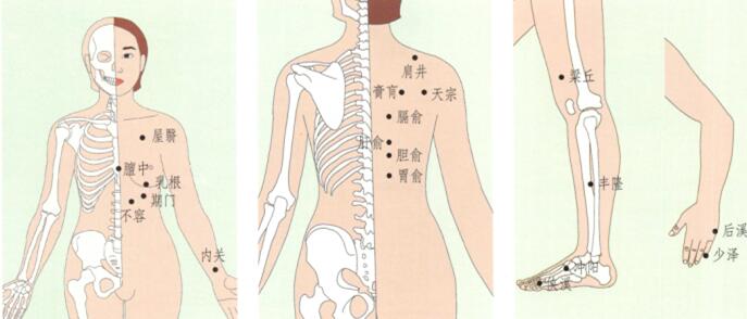 急性乳腺炎的刮痧疗法