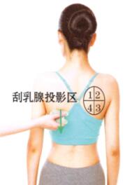 急性乳腺炎的刮痧疗法