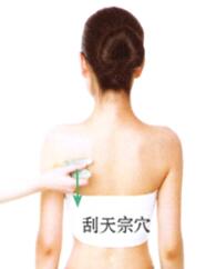 急性乳腺炎的刮痧疗法
