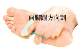 眉眼间皱纹的刮痧疗法