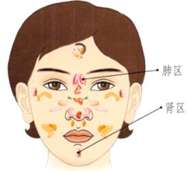 雀斑的刮痧疗法