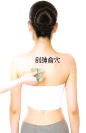 雀斑的刮痧疗法