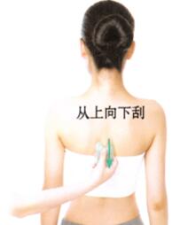 黄褐斑的刮痧疗法