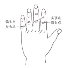 1322条图2