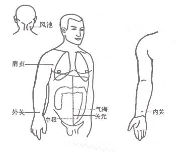 1432条图
