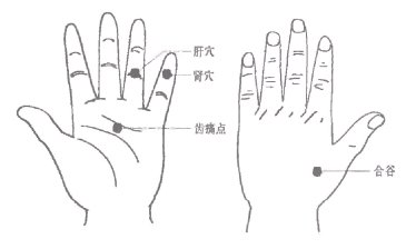 刺激手部穴位治牙痛有很好效果