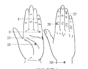 坚持手脚穴位按摩将很快治愈妇女更年期综合征