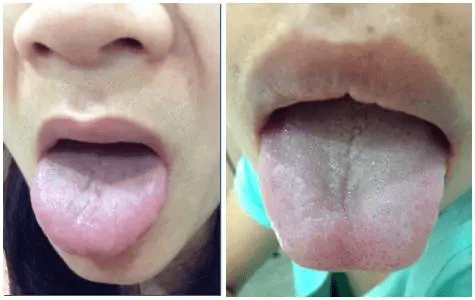 气虚体质的日常调理