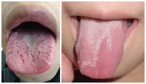 特禀体质的日常调理