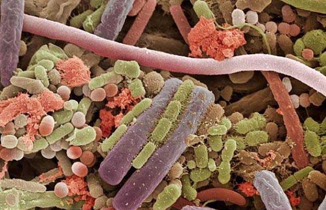 幽门螺旋杆菌阳性什么意思?