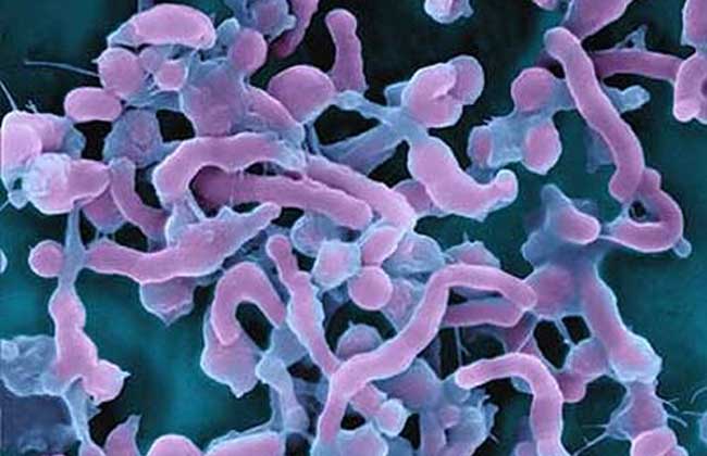 幽门螺旋杆菌阳性什么意思?