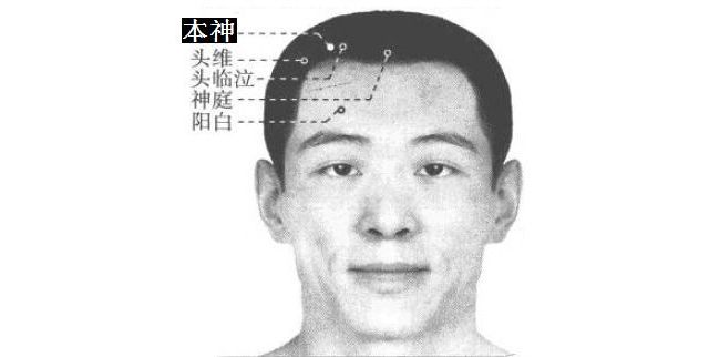 本神的证治纲要与定位图解