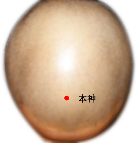 本神的证治纲要与定位图解