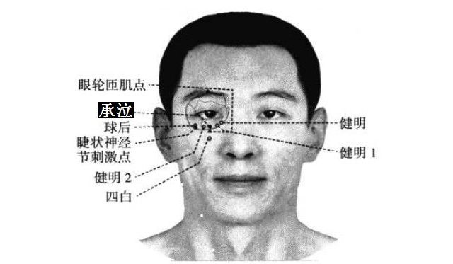 承泣的证治纲要与定位图解
