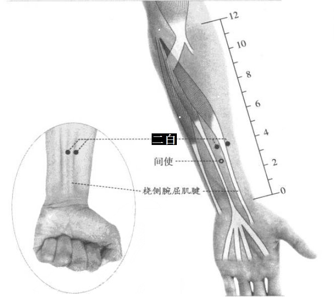 二白的证治纲要与定位图解