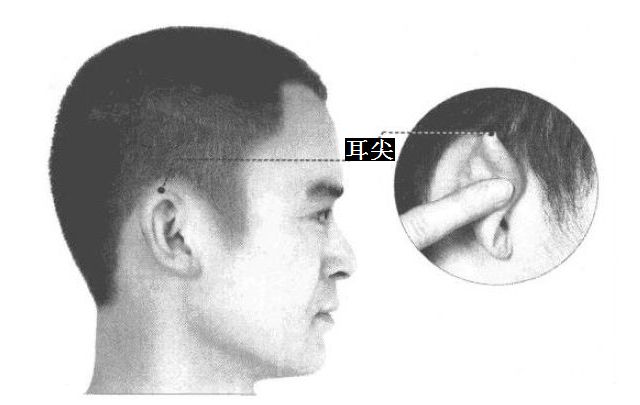 耳尖的证治纲要与定位图解