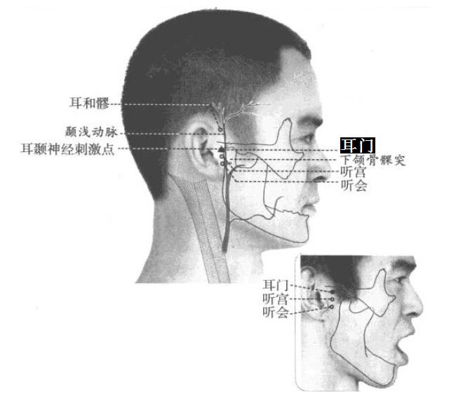 耳门的证治纲要与定位图解