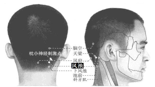 风池的证治纲要与定位图解