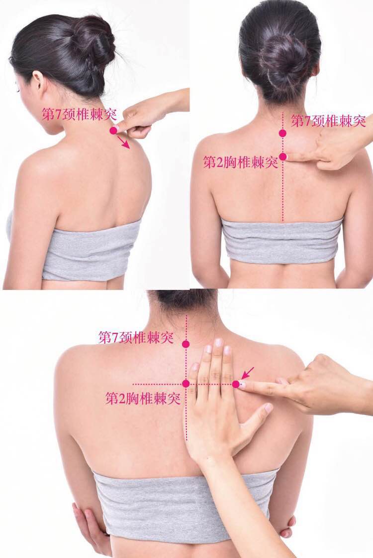 附分的证治纲要与定位图解