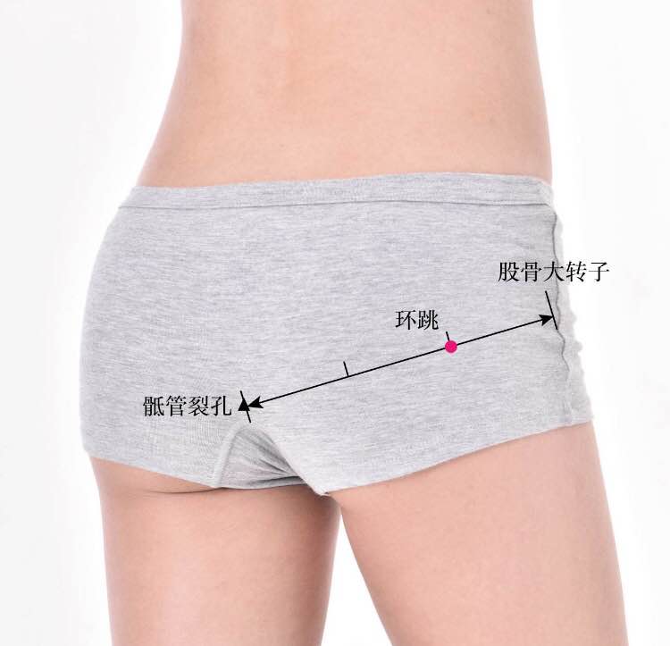 环跳的证治纲要与定位图解
