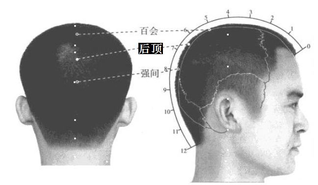 后顶的证治纲要与定位图解