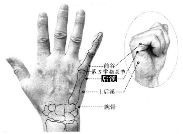后溪的证治纲要与定位图解