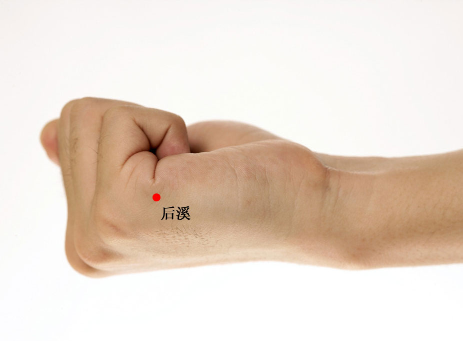 后溪的证治纲要与定位图解