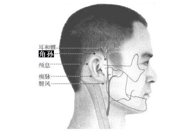 角孙的证治纲要与定位图解