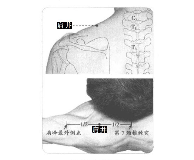 肩井的证治纲要与定位图解