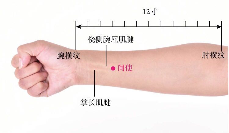 间使的证治纲要与定位图解
