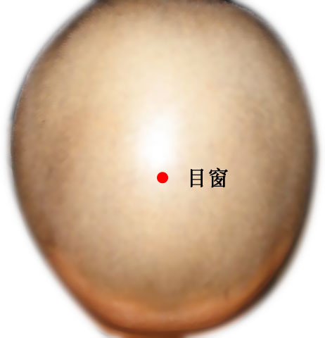 目窗的证治纲要与定位图解