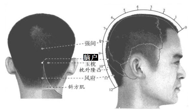 脑户的证治纲要与定位图解