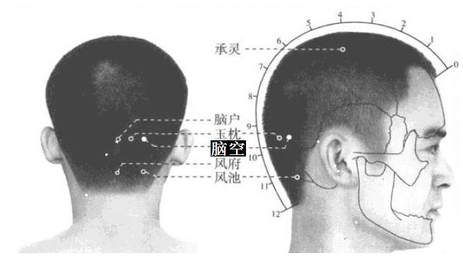脑空的证治纲要与定位图解