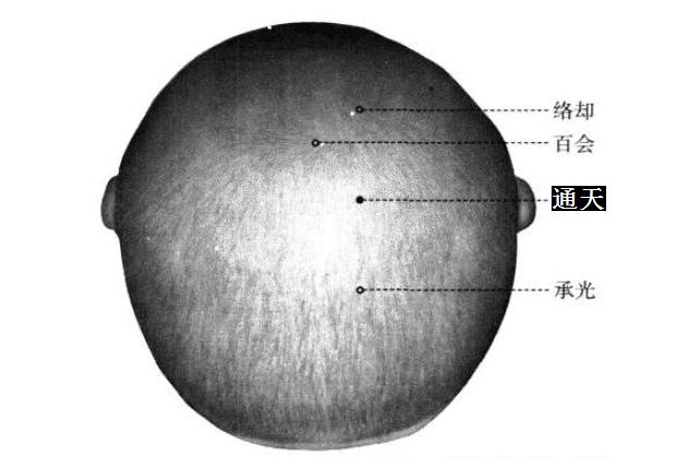 通天的证治纲要与定位图解