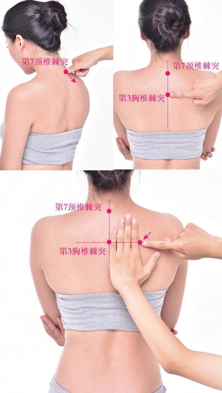 魄户的证治纲要与定位图解